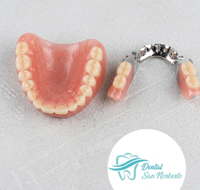 Implante Dental Rehabilitacion Oral En Lima
